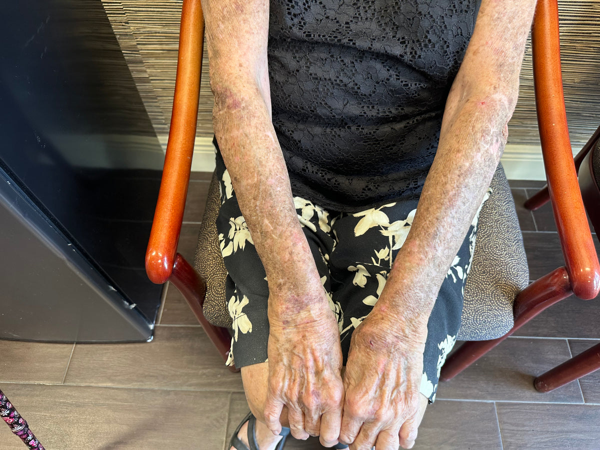 Sun-Weathered Skin - It Can Be More Harmful Than You Realize: A Case Study in the Use of Dermaka
